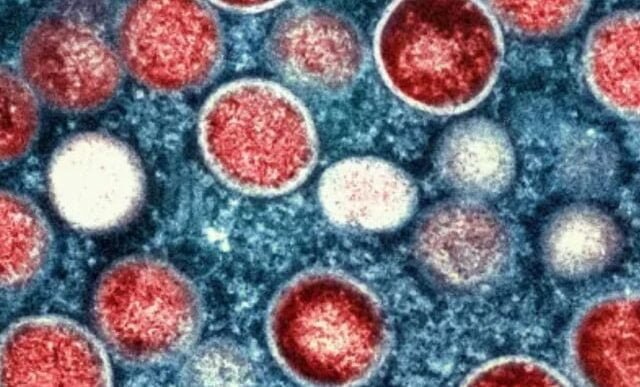 a colorised transmission electron micrograph of mpox particles in red found within an infected cell in blue photo aljazeera