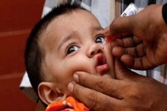 47th polio case in Sindh raises health concerns