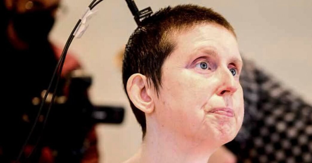 A stroke survivor speaks again with the help of an experimental brain-computer implant