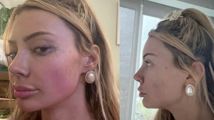Andrew Tate accuser speaks out on alleged abuse and violent encounter