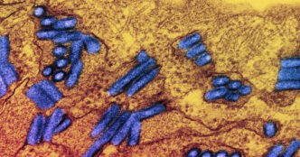Michigan patient dies after contracting rabies through transplanted organ