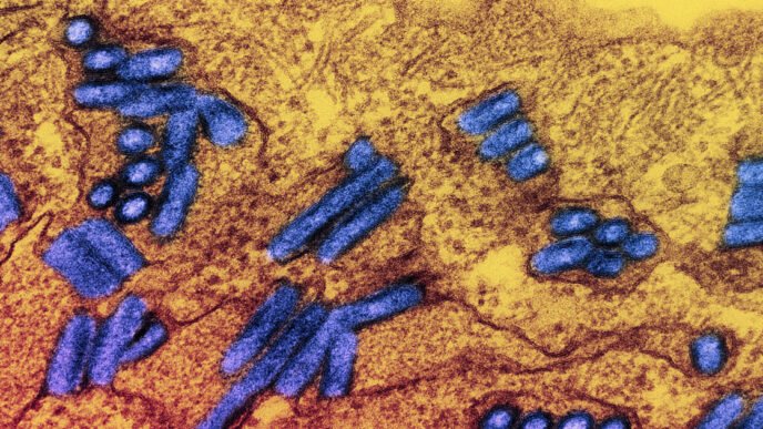 Michigan patient dies after contracting rabies through transplanted organ