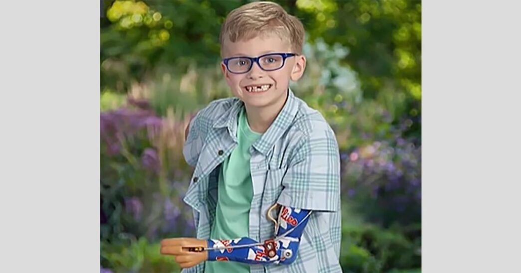 7-year-old boy gets Phillies-themed prosthetic arm