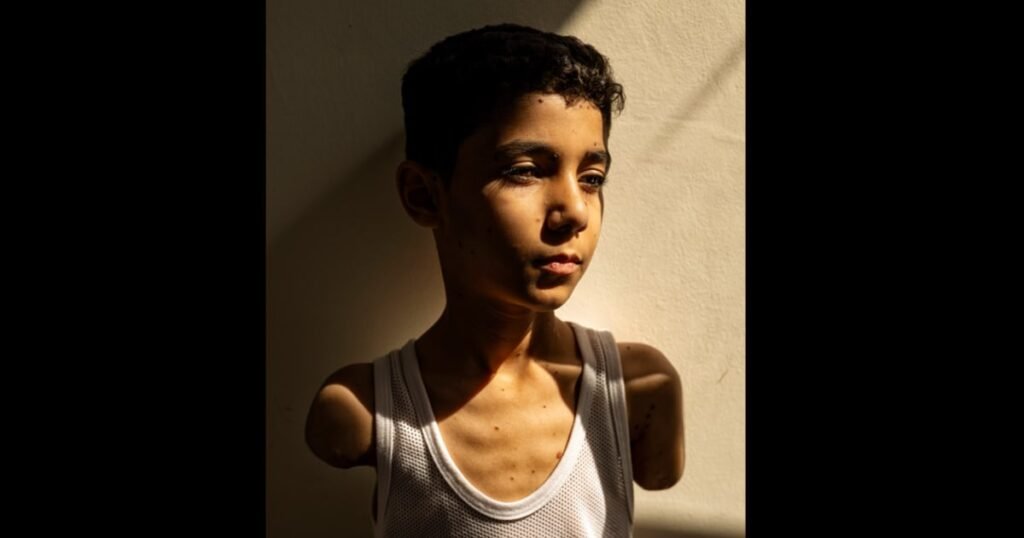 A moment of joy for a boy who lost both arms in an Israeli airstrike