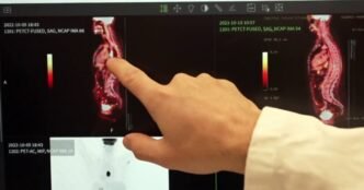 Major breakthrough in cancer treatment