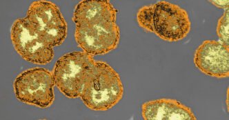 New antibiotic could be an effective treatment for drug-resistant gonorrhea
