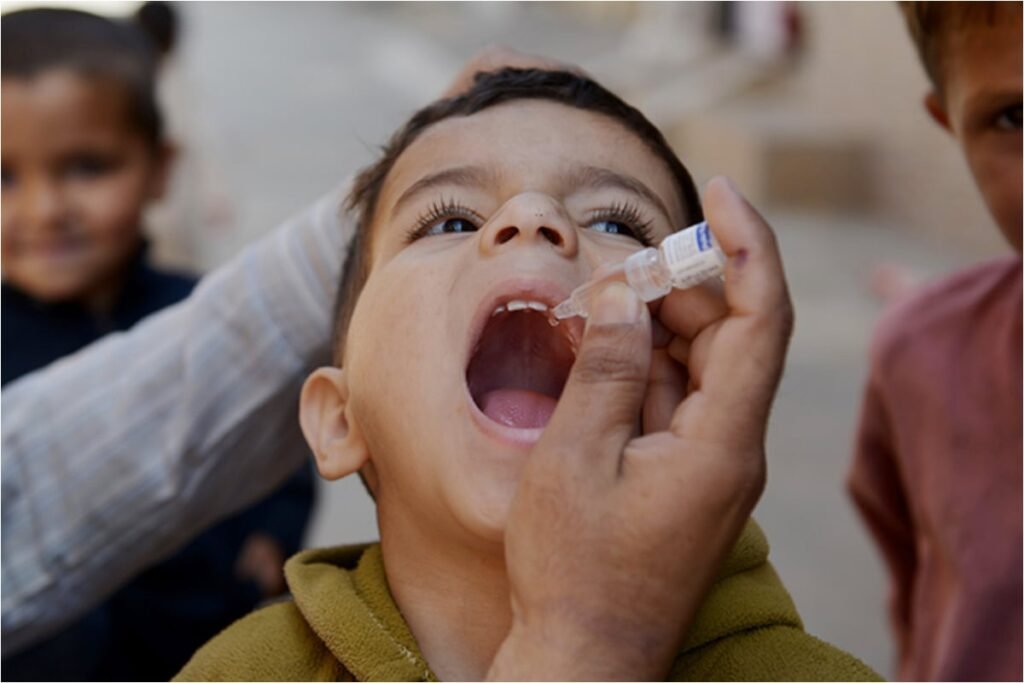 New polio case detected in KP