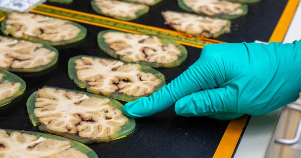 One of the country’s leading Alzheimer’s projects is in jeopardy
