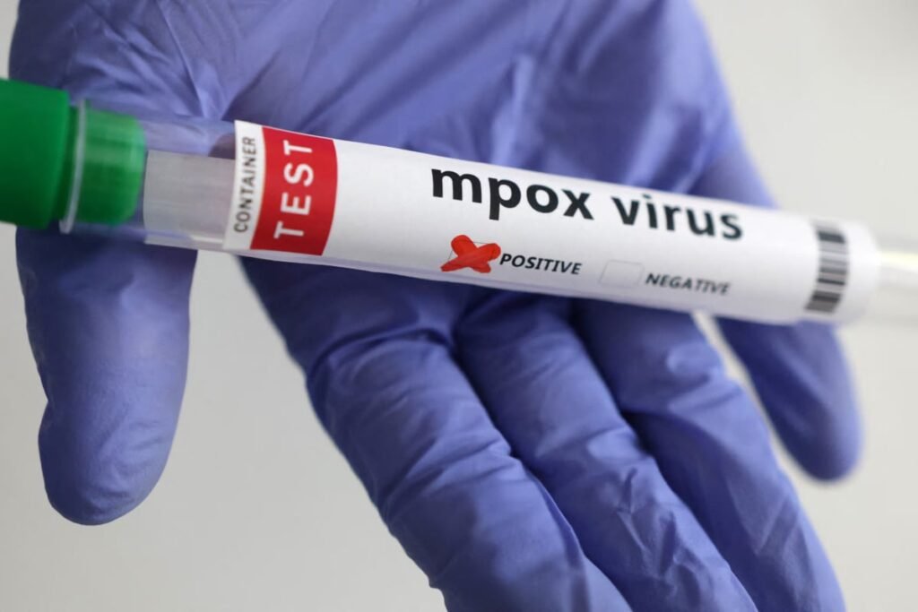 Smart lockdown imposed in Jamrud amid Mpox outbreak