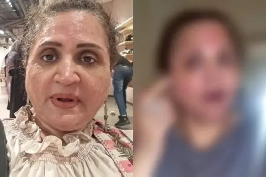 Asma Abbas’s beauty treatment gone wrong, spoiling the whole face