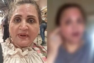 Asma Abbas’s beauty treatment gone wrong, spoiling the whole face