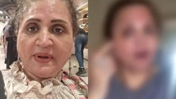 Asma Abbas’s beauty treatment gone wrong, spoiling the whole face